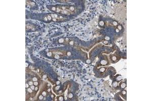 Immunohistochemical staining of human duodenum with CLCA4 polyclonal antibody  shows moderate cytoplasmic positivity in glandular cells at 1:10-1:20 dilution. (CLCA4 anticorps)