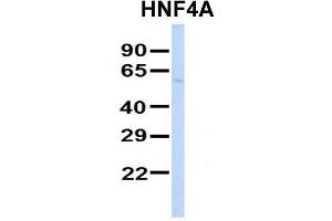 Host:  Rabbit  Target Name:  SERPINA3  Sample Type:  Human Adult Placenta  Antibody Dilution:  1. (HNF4A anticorps  (Middle Region))