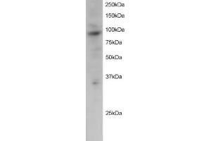 ABIN184622 staining (2µg/ml) of Jurkat lysate (RIPA buffer, 30µg total protein per lane).
