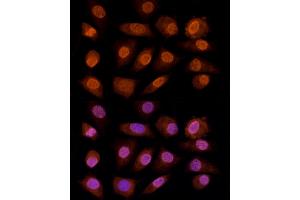 Immunofluorescence analysis of L929 cells using CRYGC antibody (ABIN6130868, ABIN6139079, ABIN6139080 and ABIN6224977) at dilution of 1:100 (40x lens).
