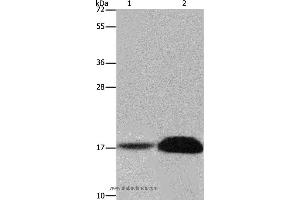 Western blot analysis of Mouse kidney and human kidney tissue, using FHIT Polyclonal Antibody at dilution of 1:600