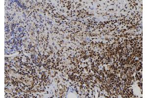 ABIN6272499 at 1/100 staining Human spleen tissue by IHC-P. (CD164L2 anticorps)
