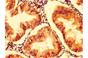 anti-Hexosaminidase A (HEXA) (AA 89-529) antibody