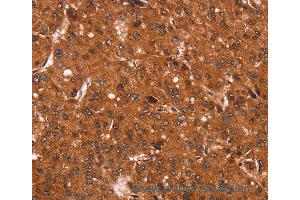 Immunohistochemistry of Human brain  using CCND3 Polyclonal Antibody at dilution of 1:40 (Cyclin D3 anticorps)