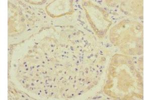 Immunohistochemistry of paraffin-embedded human kidney tissue using ABIN7154322 at dilution of 1:100 (GBF1 anticorps  (AA 1-85))