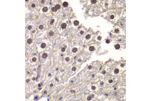 Immunohistochemistry of paraffin-embedded mouse liver using ST14 antibody at dilution of 1:200 (400x lens). (ST14 anticorps)