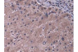 DAB staining on IHC-P; Samples: Human Liver Tissue (ABCB11 anticorps  (AA 421-663))