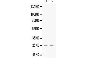 Western blot analysis of GRO gamma expression in mouse lung extract ( Lane 1) and mouse spleen extract ( Lane 2).