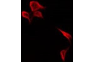 ABIN6278690 staining HepG2 by IF/ICC. (KR1_HHV11 anticorps)