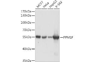 Western blot analysis of extracts of various cell lines, using PPM1F Rabbit pAb (ABIN7269682) at 1:1000 dilution. (PPM1F anticorps  (AA 1-190))