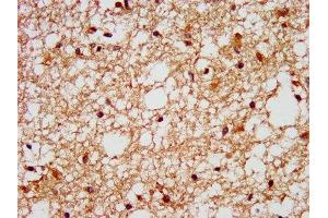 IHC image of ABIN7153159 diluted at 1:400 and staining in paraffin-embedded human brain tissue performed on a Leica BondTM system. (FFAR1 anticorps  (AA 143-178))