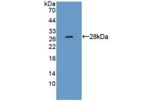 Detection of Recombinant CRMP1, Human using Polyclonal Antibody to Collapsin Response Mediator Protein 1 (CRMP1) (CRMP1 anticorps  (AA 1-250))