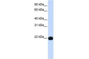 Image no. 1 for anti-Phosphatidylinositol Glycan Anchor Biosynthesis, Class A (PIGA) (AA 117-166) antibody (ABIN6743361) (PIGA anticorps  (AA 117-166))