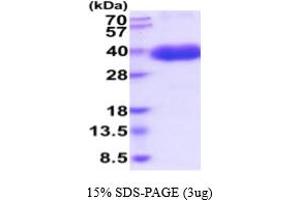 SDS-PAGE (SDS) image for Colony Stimulating Factor 1 (Macrophage) (CSF1) (AA 33-255) (Active) protein (His tag) (ABIN7281234)