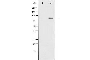 Western blot analysis of STAT4 expression in HeLa whole cell lysates,The lane on the left is treated with the antigen-specific peptide. (STAT4 anticorps  (C-Term))
