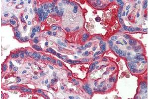 Placenta, Human: Formalin-Fixed, Paraffin-Embedded (FFPE) (Cadherin 5 anticorps)