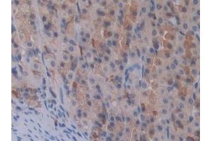 Detection of STAT2 in Rat Stomach Tissue using Polyclonal Antibody to Signal Transducer And Activator Of Transcription 2 (STAT2)