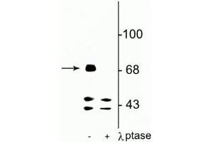 Western blot of rat hippocampal lysate showing specific immunolabeling of the ~71 kDa FMRP protein phosphorylated at Ser499 in the first lane (-). (FMR1 anticorps  (pSer499))