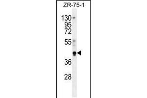 Western blot analysis in ZR-75-1 cell line lysates (35ug/lane). (PYGO1 anticorps  (C-Term))