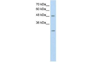 WB Suggested Anti-ANKRD2 Antibody Titration:  0. (ANKRD2 anticorps  (N-Term))