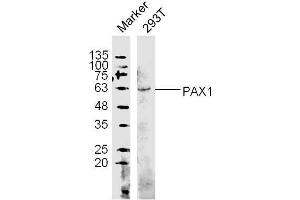 (Human Cell line) 293T lysates probed with PAX1 Polyclonal Antibody, unconjugated  at 1:300 overnight at 4°C followed by a conjugated secondary antibody at 1:10000 for 60 minutes at 37°C. (PAX1 anticorps  (AA 151-250))