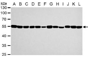 WB Image alpha Tubulin 1A antibody detects alpha Tubulin 1A protein by western blot analysis.