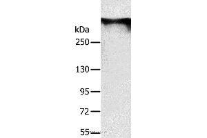 Western blot analysis of Mouse brain tissue, using RYR1 Polyclonal Antibody at dilution of 1:300 (RYR1 anticorps)