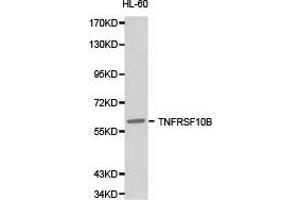 Western Blotting (WB) image for anti-Tumor Necrosis Factor Receptor Superfamily, Member 10b (TNFRSF10B) antibody (ABIN1875126) (TNFRSF10B anticorps)