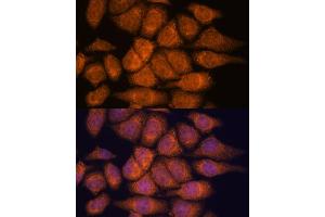 Immunofluorescence analysis of HeLa cells using UPF3A antibody (ABIN7271227) at dilution of 1:100. (UPF3A anticorps  (AA 327-476))