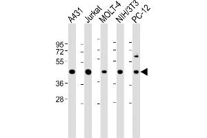 All lanes : Anti-ASS Antibody (Center) at 1:2000 dilution Lane 1: A431 whole cell lysate Lane 2: Jurkat whole cell lysate Lane 3: MOLT-4 whole cell lysate Lane 4: NIH/3T3 whole cell lysate Lane 5: PC-12 whole cell lysate Lysates/proteins at 20 μg per lane.
