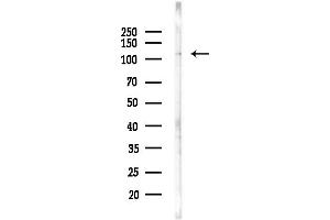 Western blot analysis of lysates from COLO205 cells(heat-shock,45 min treatment), using Phospho-NF kappaB p105/p50 (Ser927) Antibody at 1/1000 dilution.