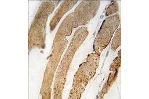Formalin-fixed and paraffin-embedded human skeletal muscle tissue reacted with PDK4 antibody (Center), which was peroxidase-conjugated to the secondary antibody, followed by DAB staining. (PDK4 anticorps  (Middle Region))