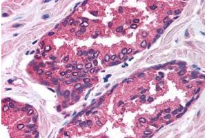 Human Prostate (formalin-fixed, paraffin-embedded) stained with FOXP2 antibody ABIN214758 at 2. (FOXP2 anticorps  (AA 71-120))