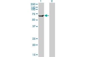 Western Blot analysis of TRIM16 expression in transfected 293T cell line by TRIM16 monoclonal antibody (M01), clone 5F4.