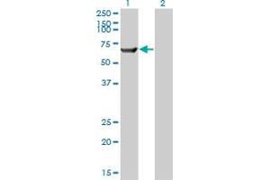 Western Blot analysis of TRIM16 expression in transfected 293T cell line by TRIM16 monoclonal antibody (M01), clone 5F4. (TRIM16 anticorps  (AA 165-273))