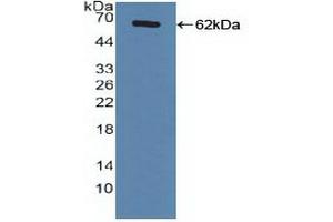 Figure. (NR1H4 anticorps  (AA 211-486))