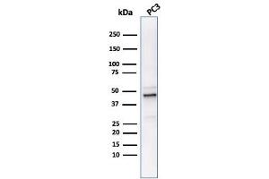 anti-Ornithine Decarboxylase 1 (ODC1) antibody