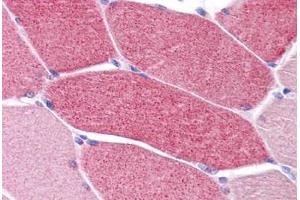 Human Skeletal Muscle: Formalin-Fixed, Paraffin-Embedded (FFPE)