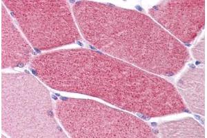 Human Skeletal Muscle: Formalin-Fixed, Paraffin-Embedded (FFPE) (LRRC19 anticorps  (C-Term))