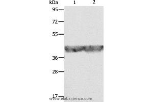Western blot analysis of A549 and hela cell, using ALDOA Polyclonal Antibody at dilution of 1:500 (ALDOA anticorps)
