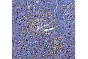 IHC analysis of ARID1A using anti-ARID1A antibody (ABIN7602567). (ARID1A anticorps  (AA 857-1552))