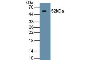 Detection of Recombinant IFNk, Human using Polyclonal Antibody to Interferon Kappa (IFNk) (IFNK anticorps  (AA 28-207))