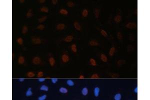 Immunofluorescence analysis of U-2 OS cells using BRD4 Polyclonal Antibody at dilution of 1:100 (40x lens). (BRD4 anticorps)