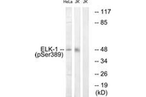 Western blot analysis of extracts from Jurkat cells treated with UV 15' and HeLa cells treated with paclitaxel 1uM 24h, using Elk1 (Phospho-Ser389) Antibody. (ELK1 anticorps  (pSer389))
