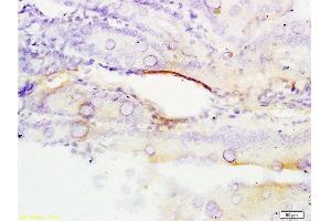 Formalin-fixed and paraffin embedded rat colon tissue labeled with Anti-ERCC1 Polyclonal Antibody, Unconjugated  at 1:200 followed by conjugation to the secondary antibody, (SP-0023), and DAB staining