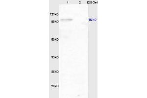 Lane 1: mouse brain lysates Lane 2: mouse lung lysates probed with Anti phospho-IKK beta(Tyr199) Polyclonal Antibody, Unconjugated (ABIN743243) at 1:200 in 4 °C. (IKBKB anticorps  (pTyr199))