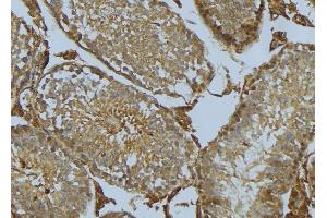 ABIN6275278 at 1/100 staining Mouse testis tissue by IHC-P. (CYB5R3 anticorps  (C-Term))