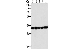 Western Blotting (WB) image for anti-Mitochondrial Carrier 2 (MTCH2) antibody (ABIN2430475) (MTCH2 anticorps)
