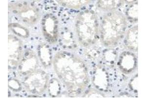 Figure. (MTUS1 anticorps  (AA 1018-1270))