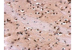 IHC-P Image MEF2A antibody [C2C3], C-term detects MEF2A protein at nucleus on rat fore brain by immunohistochemical analysis. (MEF2A anticorps  (C-Term))